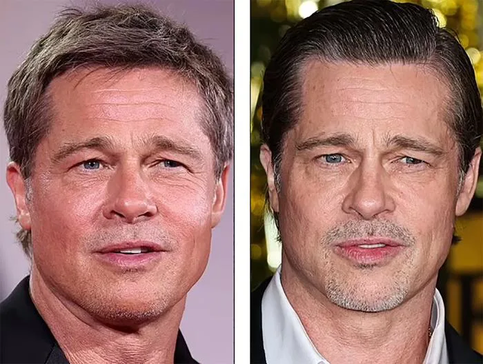 Brad Pitt trẻ lâu nhờ phẫu thuật thẩm mỹ?
