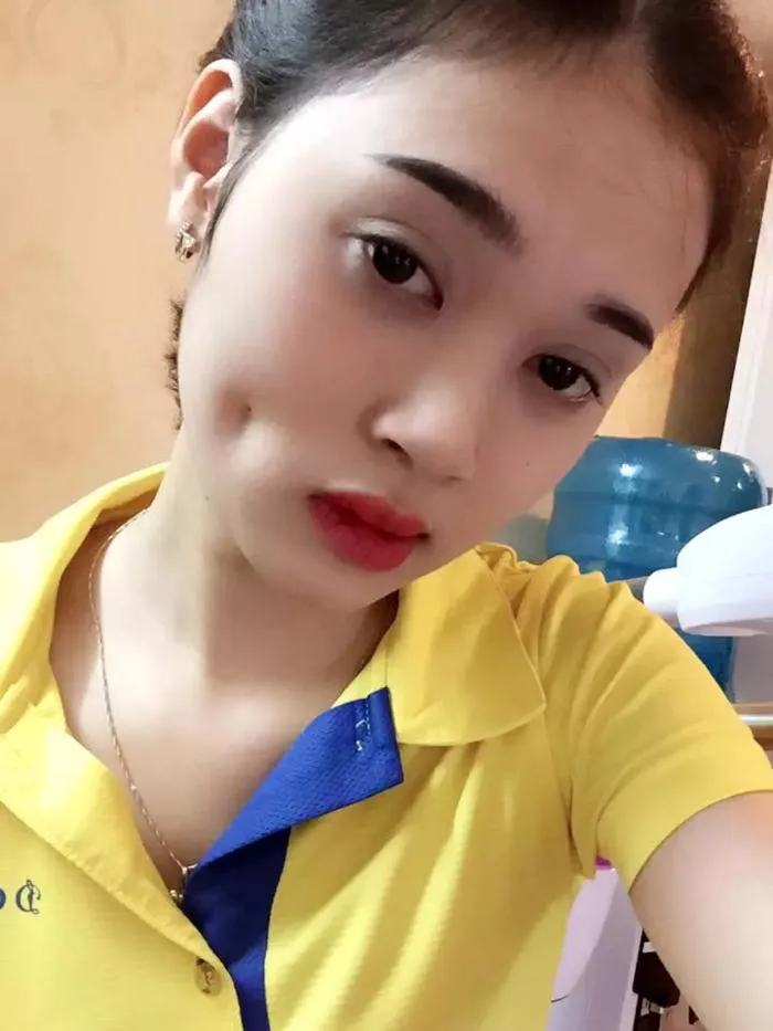 Ham má lúm đồng tiền khuôn mặt cô gái trẻ bị biến dạng