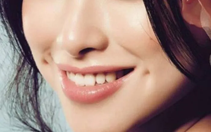 Chiêm ngưỡng những lúm đồng tiền ở khóe miệng cực xinh
