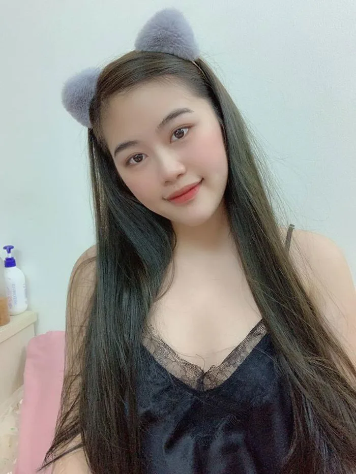 Cô giáo mầm non bị bỏng nặng do nổ bóng bay: “Người tôi chằng chịt những  vết sẹo không thể xóa mờ”