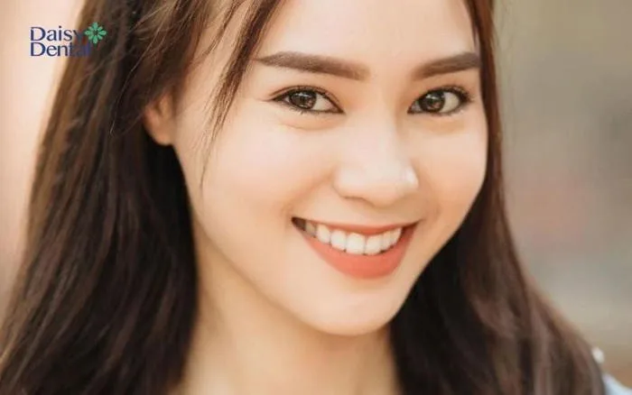100+ Hình ảnh nụ cười đẹp mang lại năng lượng tích cực