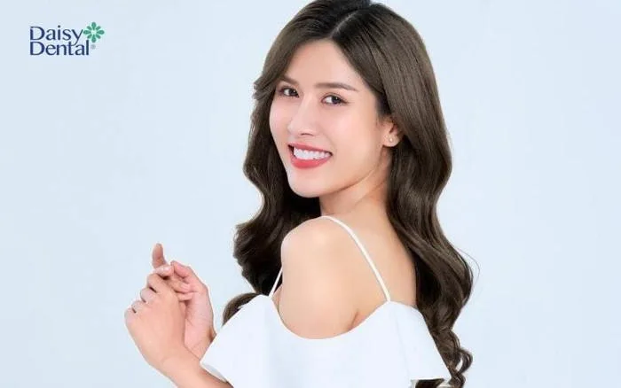 100+ Hình ảnh nụ cười đẹp mang lại năng lượng tích cực