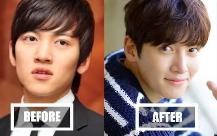 Netizen Hàn so sánh ảnh trước và sau phẫu thuật của Ji Chang Wook -  Saostar.vn