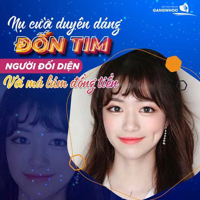 Tạo Má Lúm Đồng Tiền Có lâu dài Không? Bác Sĩ Giải Đáp