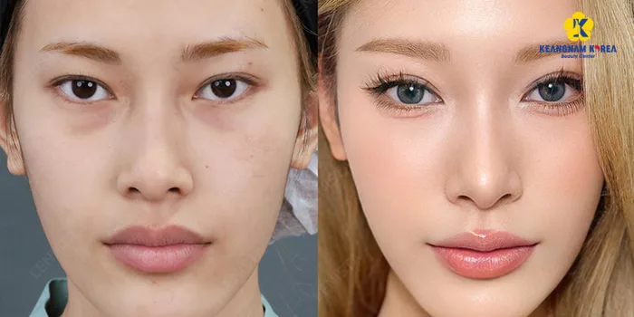 Mắt 2 mí lót là gì? Đẹp hay xấu? Mắt mí lót có ý nghĩa gì trong tướng số nam và nữ? - Keangnam Korea Mắt 2 mí lót là gì? Đẹp hay xấu? Mắt mí lót có ý nghĩa gì trong tướng số nam và nữ? - Keangnam Korea