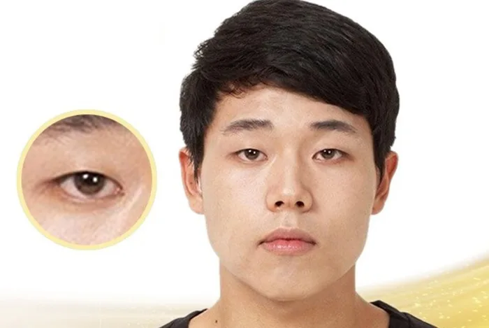 Mắt 1 mí đẹp hay xấu? 3 Cách khắc phục hiệu quả