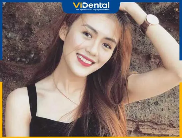 Răng Khểnh Là Gì, Có Nên Giữ Lại Không Và Các Thông Tin Liên Quan